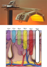 Traitement esth&eacute;tique LED &agrave; Lille